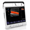 MSLCU25 Portable Color Digital Ultrasonic Diagnostic Imaging Machine For Hospital