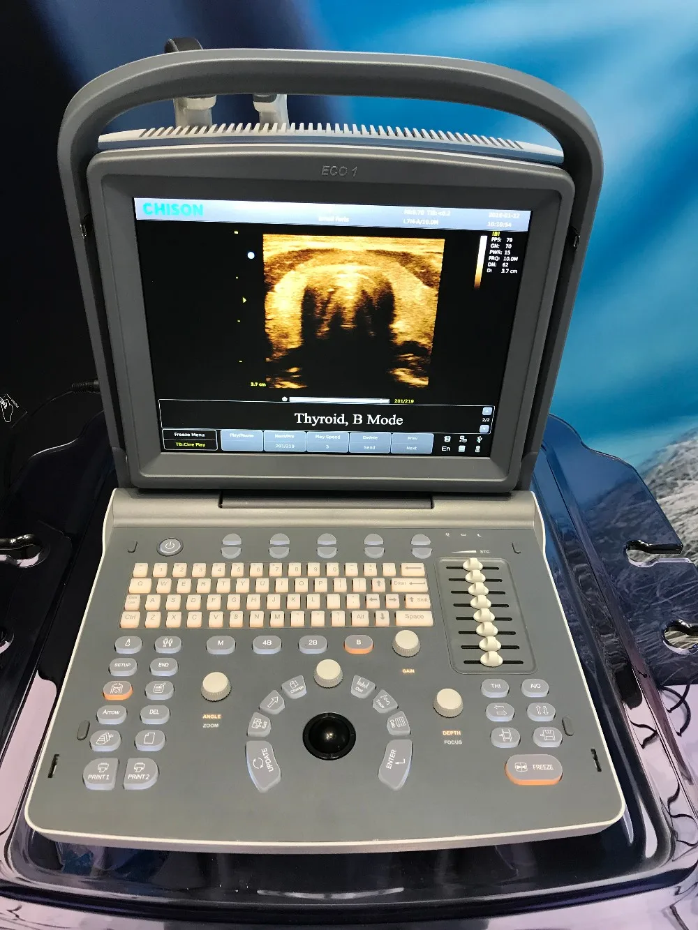 2018 Professional Veterinary Ultrasound Machine Chison Eco1 Vet