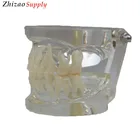 Dental clear primary teeth model, transparent baby teeth model