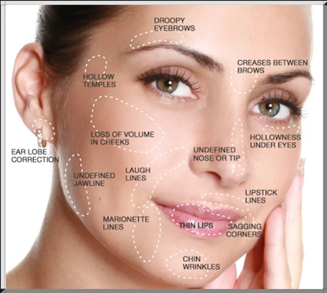 Dermal-Fillers-Image.png