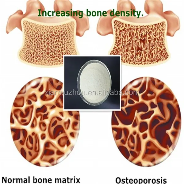 Gmp Manufacturer Natural Pure Cattle Bone Collagen For Bone Density