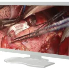 Monitor 24 Endoscope Monitor Full HD LCD Medical Endoscope Monitor For ENT Laparoscopy Arthroscopy 24 Inch