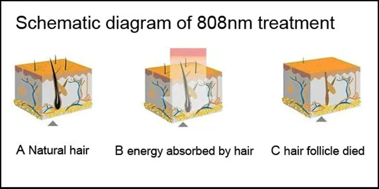 808nm princeple.jpg