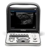Famous brand Sonoscape A5 portable black & white ultrasonic system ultrasound machine cheapest price
