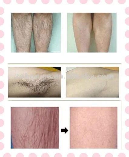 Multilingual spare parts for 810nmnm laser