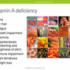 High Quality Vitamin A Palmitate Oil 1.0/1.7MIU