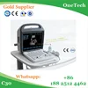 /product-detail/ultrasound-machine-c30-color-doppler-laptop-portable-pretty-ultrasound-scanner-hospital-used-medical-equipment-60614841298.html