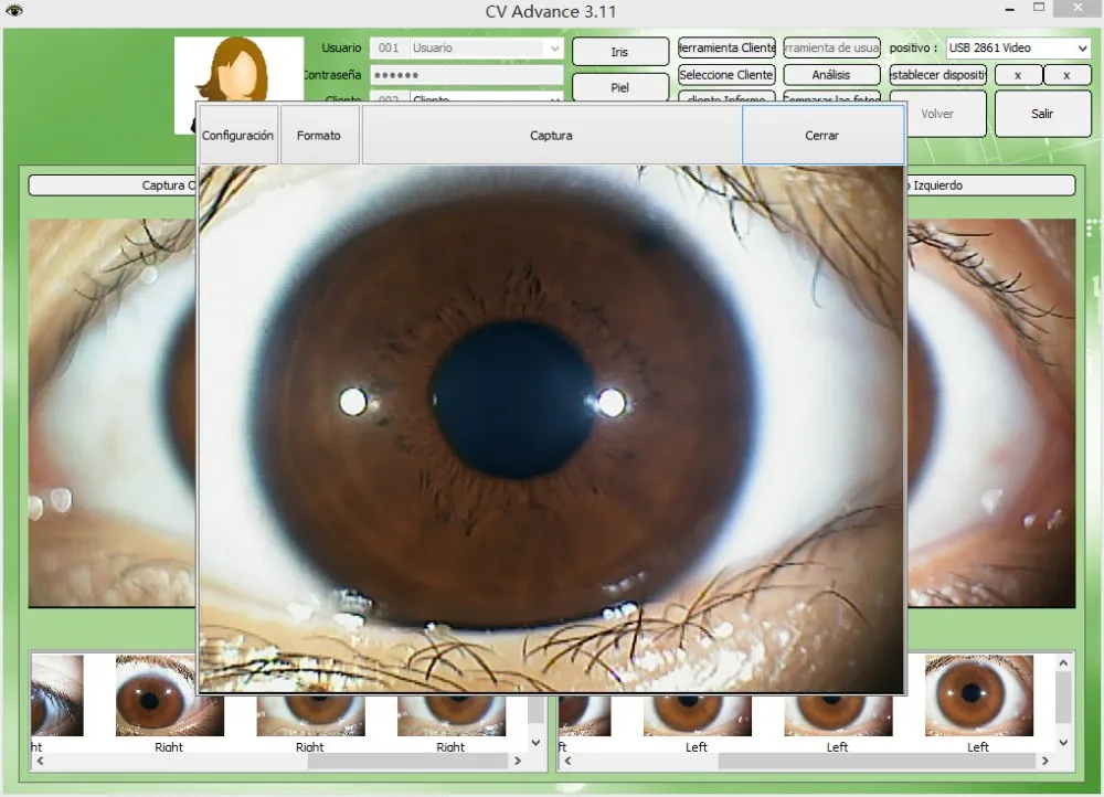 Analizador De Iris Pro De C Mara De Iridolog A Ocular Usb De Mp