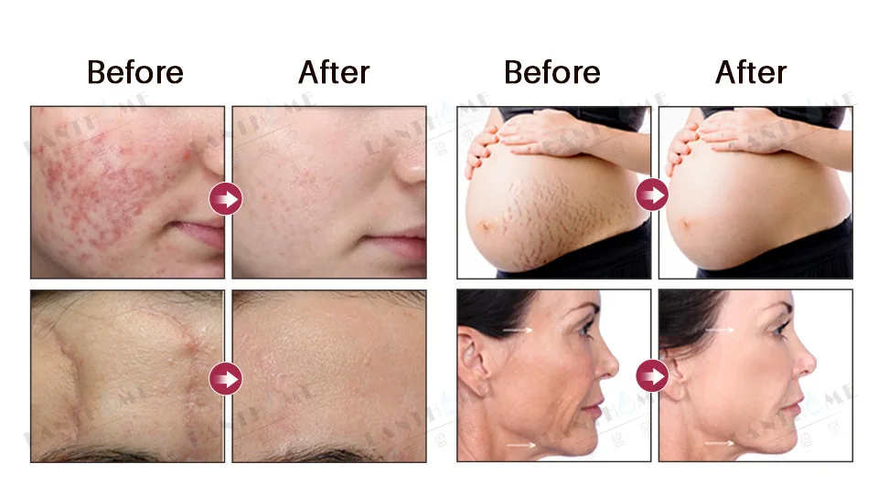 rosehip oil (3).jpg