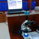 USB digital binocular blood microscope manufacturer