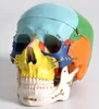Adult colored anatomical skull model for medical demonstration with normal fracture part fixed by titanium plate