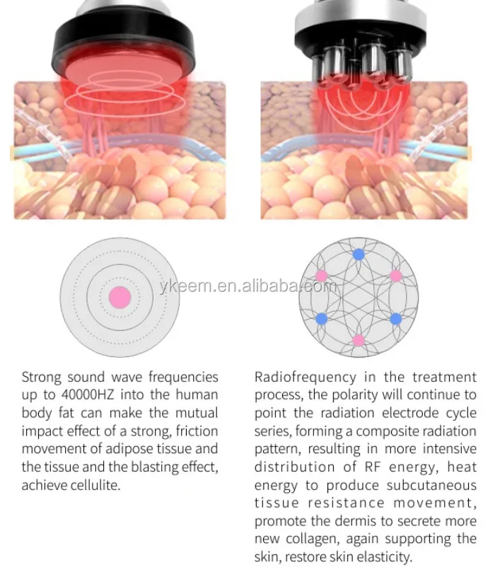 cryolipolysis fat freeze slimming machine.jpg