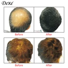 Hair Oil Building Hair Fibers Hair Building Fibers Oil