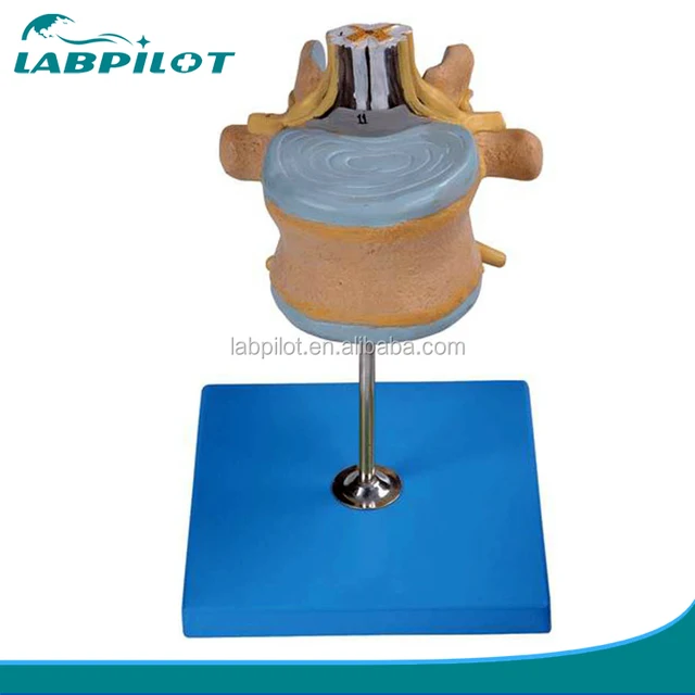 lumbar vertebra model with cauda equina, anatomical waist spine