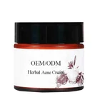 Advanced anti acne scar cream Removal Healthy Oil Balance All Natural Herbal Formula acne treatment cream