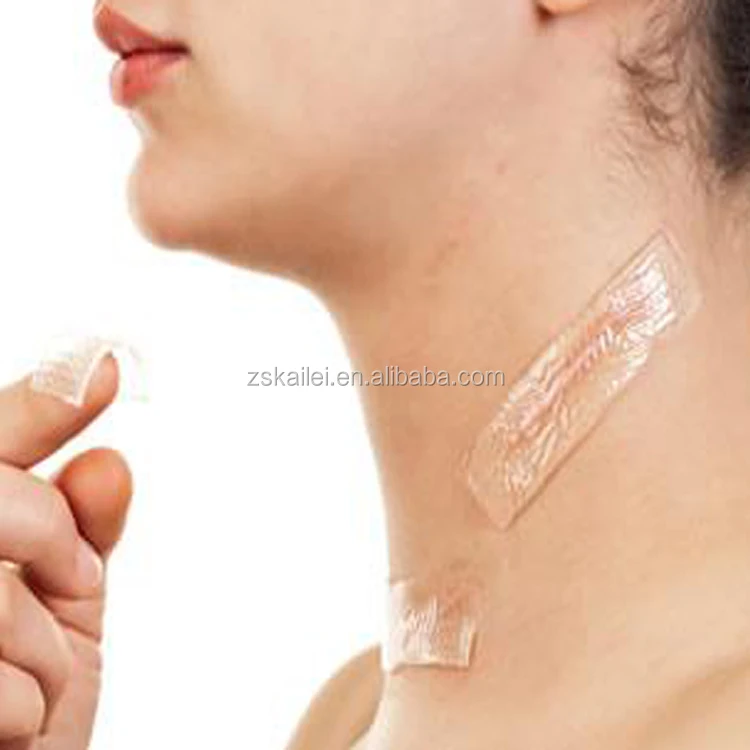 silicone pad scar treatment