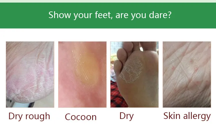 foot mask3