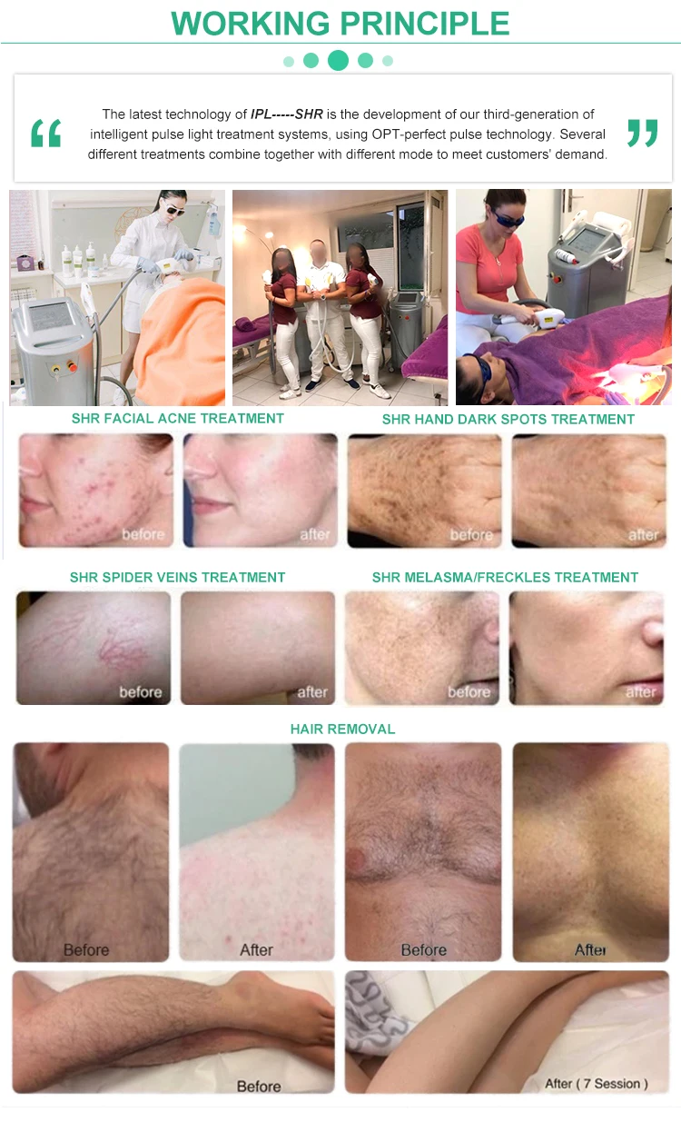 CE approved adena ipl SHR hair removal machine