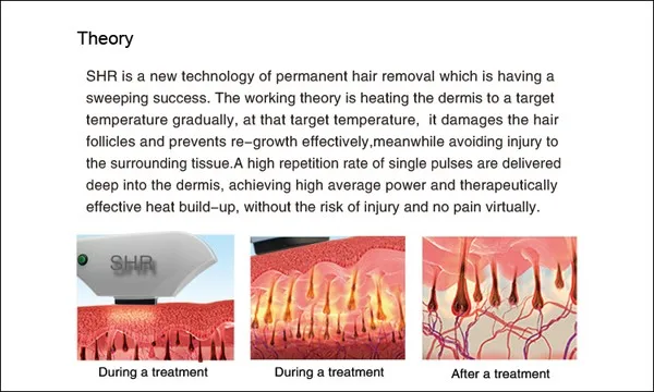 SHR OPT IPL beauty machine