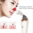 beauty machine electronic pore cleaner deep cleaner vaccum blackhead remover