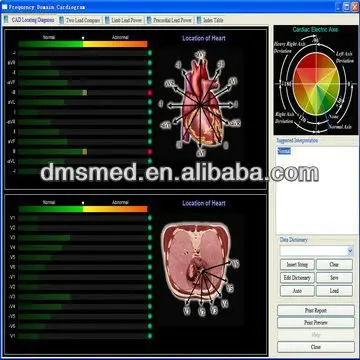 Serial Ecg Frequency