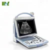 THI Full Digital Mindray Ultrasound DP - 10 / Hot Sale!! Good Price 12.1 Inch LED Mindray Ultrasound