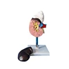 Artificial Plastic Kidney Anatomic Model