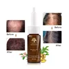 Private Label Bald Head Treatment Product Organic Ginger Oil Anti Hair Loss Serum For Hair Growth