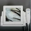 AYJ-J015 boxy lcd monitor skin scope analyzer / hair skin analyzer magnifier from china