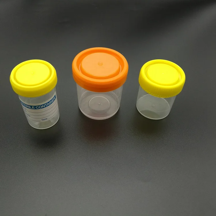 urine cup (3).jpg