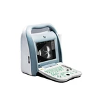 Cataract Surgery Instrument a/B Ultrasound Scanner Eyes Equipment