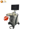 New arrival 15 inch 3D trolley color doppler ultrasound with 4 probe connectors