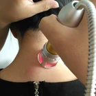2019 Newest 60W 980+810nm infrared physiotherapy equipment chiropractic laser acupuncture device