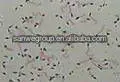 Sperm