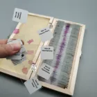 wooden box of 50pcs pathology slides from human disease tissue