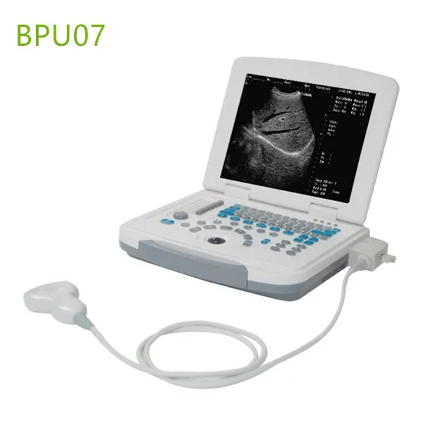 Laptop Portable Ultrasound Machines , Portable ultrasound machines , Portable ultrasound machine price , used Portable ultrasound machine , best laptop ultrasound machine , Portable ultrasound factory sell directly , price from medical ultrasound , medical scan machines ,ultrasound echo machine , ultrasound scanner , pregnancy test ultrasound machines , portable ultrasound scanner , mindry ultrasound scanner , cheapest usg , low price ultrasound scanner