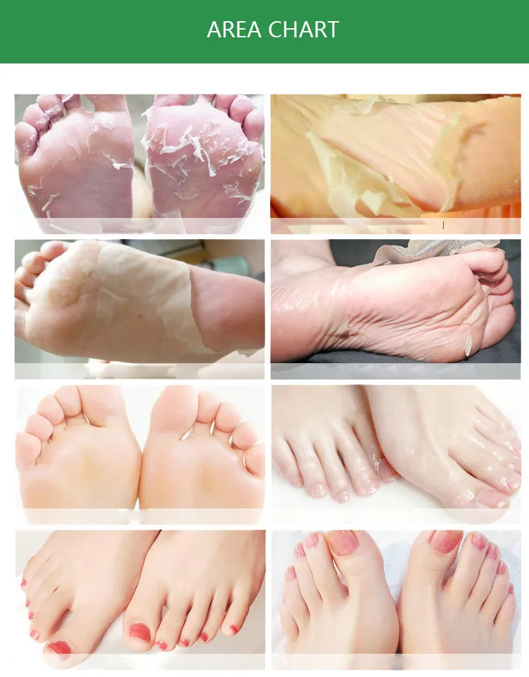 foot mask9