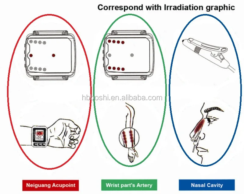 laser irradiation part