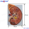 PNT-0560cc Kidney Model with Adrenal Gland,Medical Kidney Anatomy Model