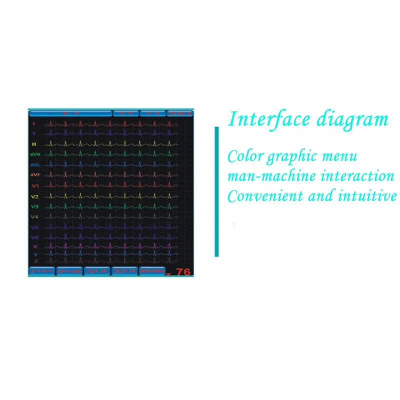 KX1203 3 Channel portable digital electrocardiograph