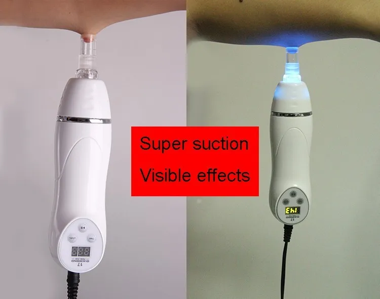 CE certificate Wrinkle removing machine/Blackhead Removal machine/diamond microdermabrasion machine for personal use