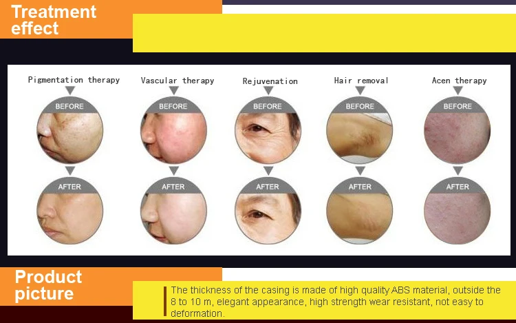 reduce acne scars fast 5k reduce acne scars fast 5k
