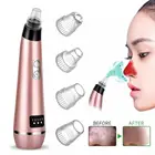 2019 Best Skin Care Hot Sell Beauty Acne Black Head Remover Comedo Suction Blackhead Remover Vacuum
