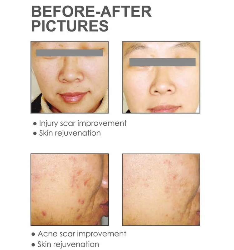 Before & After.jpg