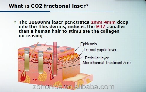 Co2 Laser skin resurfacing scar removal warts removal/co2 laser vaginal applicator vertical model high performance