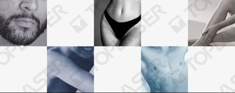 808nm Hair removal.jpg