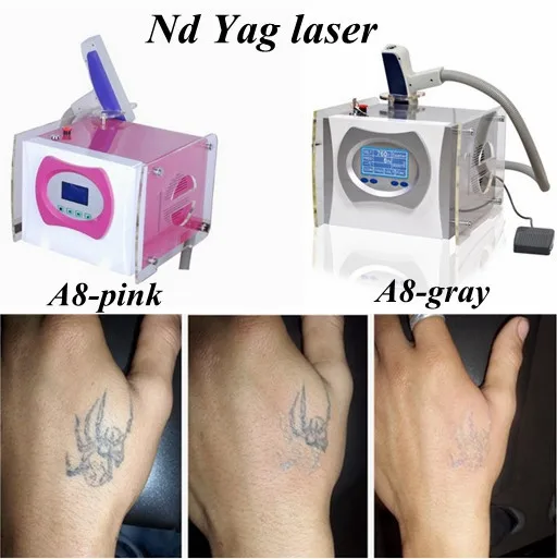 best-selling q switch nd yag laser tattoo/pigmentation removal machine 1064nm 532nm