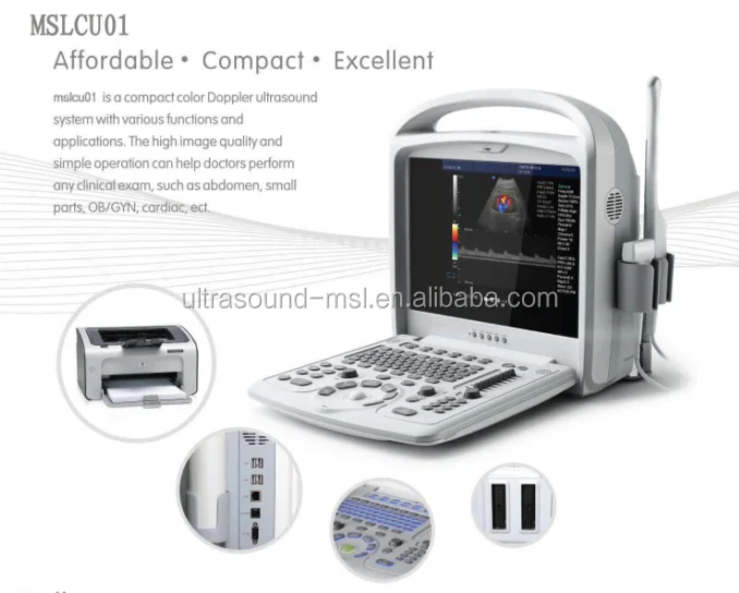 high quality color doppler ultrasound machine/doppler vascular