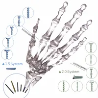 Orthopedic Titanium Implant Bone Fracture Mini