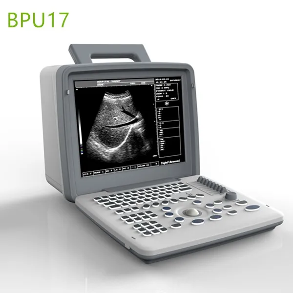 4D Ultrasound echo machines ,4D used ultrasound machines,4D ultrasound scanner,medical scan machines,4D ultrasound machines ,4D Laptop Ultrasound machines, Portable Ultrasound 4D , Handheld ultrasound Machines , Laptop Portable Ultrasound Machines , Portable ultrasound machines , Portable ultrasound machine price , used Portable ultrasound machine , best laptop ultrasound machine , Portable ultrasound factory sell directly , price from medical ultrasound , medical scan machines ,ultrasound echo machine , ultrasound scanner , pregnancy test ultrasound machines , portable ultrasound scanner , mindry ultrasound scanner , cheapest usg , low price ultrasound scanner , new ultrasound echo machines price,portable ultrasound scanner,laptop echo machines,medical scan machines,usg,ultrasound machine price